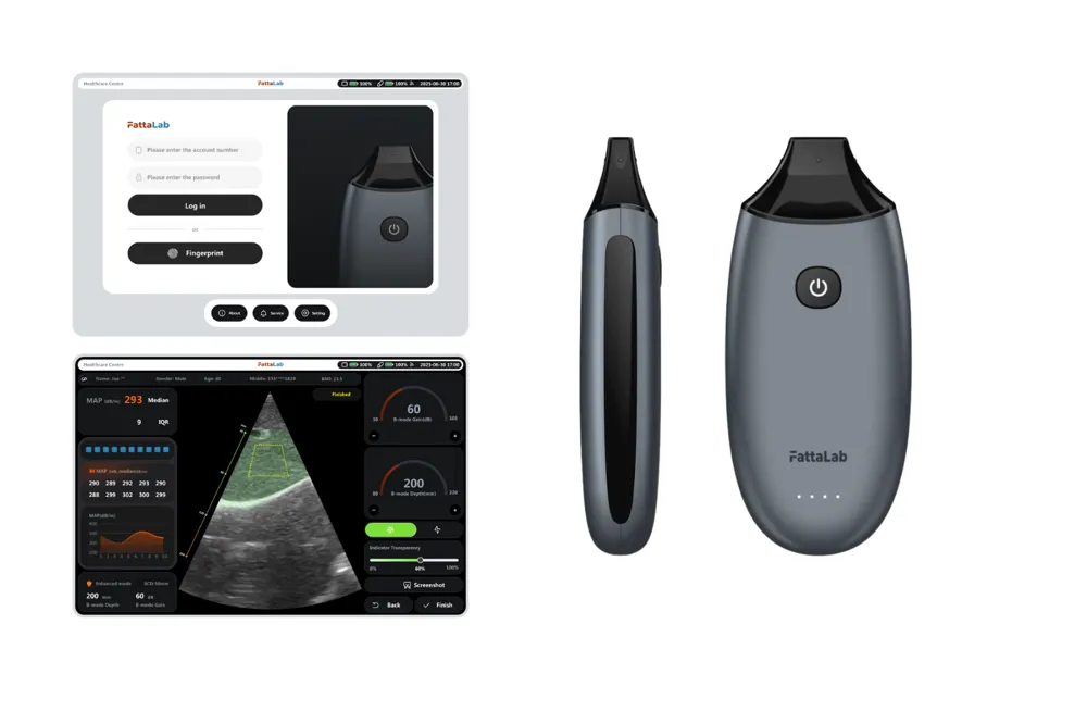 FattaLab® 지방간 진단 기기